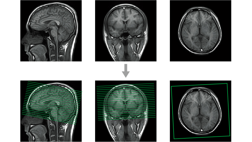 pic_echelon-smart_66